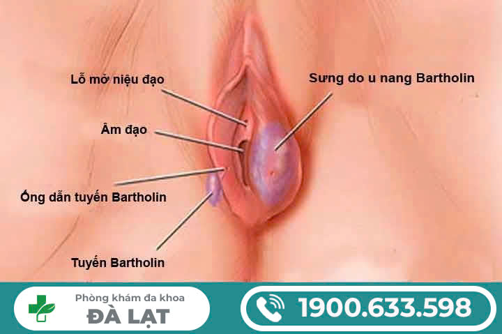 Hình ảnh minh họa